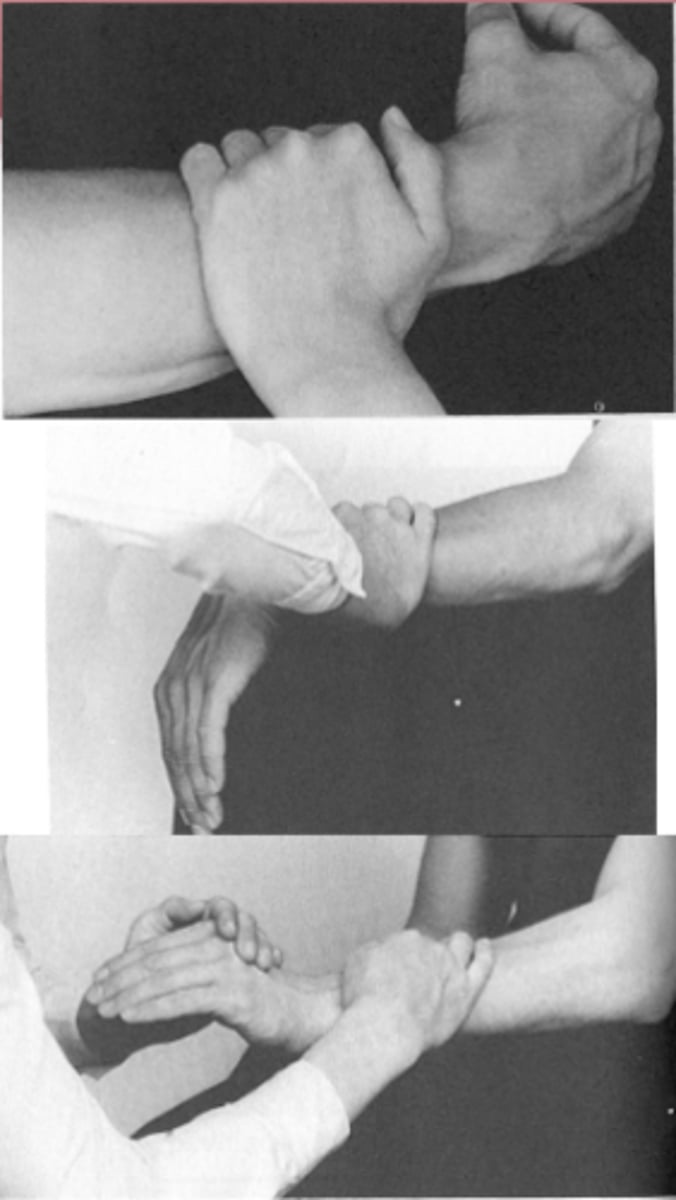 <p>alkar teljes hosszában alátámasztva, azt rögzítem</p><p>> csuklóval hátrafelé, felfelé sepregessen (kisujjnál támaszkodik a kéz) azaz dorsalflexiót és radialdeviatiót kérek</p>