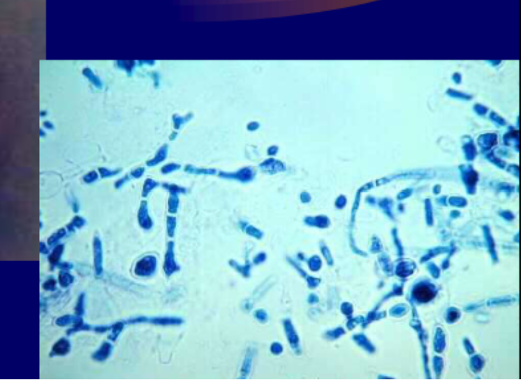 <p>Micro: <strong>numerous chlamydospores, bizarre branching</strong></p><p>Macro: violet with white overgrowth obverse, white-buff-lavender-purple reverse</p>