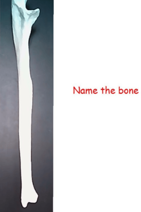 <p>name the bone </p>