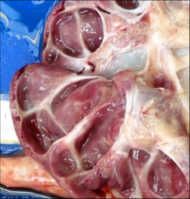 <p>What type of pathological change is most likely to have affected the renal parenchyma?</p>