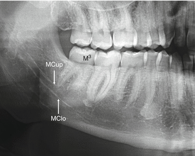 <p>what is this, its description and its appearance on images</p>