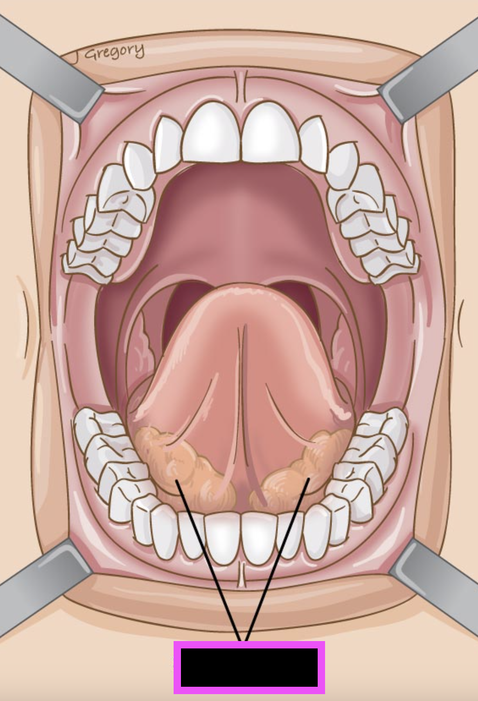 term image