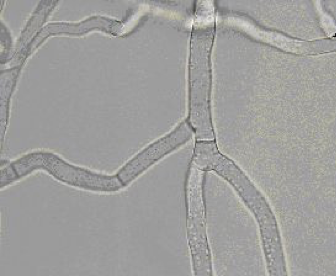 <ul><li><p>y-branching</p></li><li><p>Cross walls</p></li><li><p>No spores</p></li></ul><p></p>