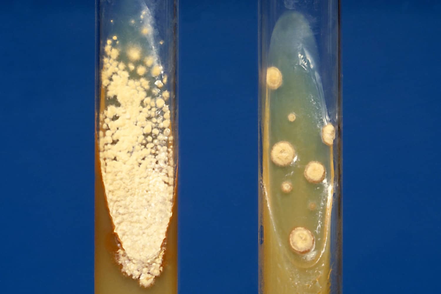 <p>— Slanting the surface of the agar<strong> gives the bacteria a greater surface area on which to grow in a test tube.</strong></p><p>— Slants are created in test tubes that can be capped, which minimises water loss. </p><p>— Cultures can be stored for a longer time.</p>