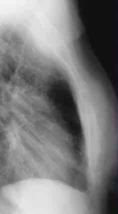 <p>What is this x-ray demonstrating?</p>