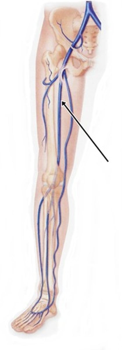 <p>major vein of thigh, receives blood from deep femoral and great saphenous vein</p>