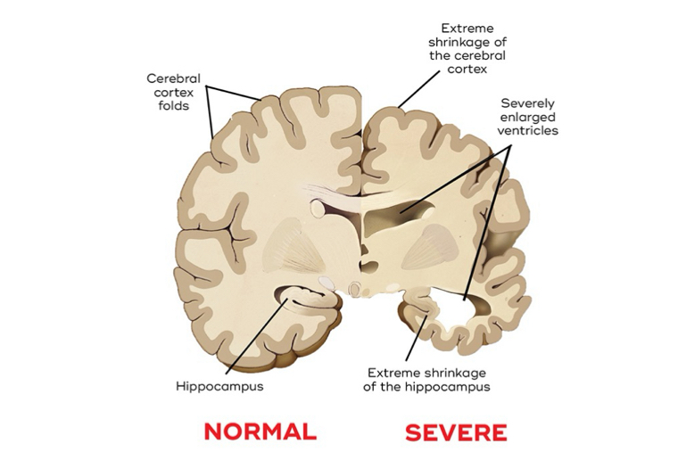 <p>performance disruption occurs gradually as part of the system or damaged</p>