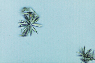 <p>Identify the urine sediment element shown:</p>