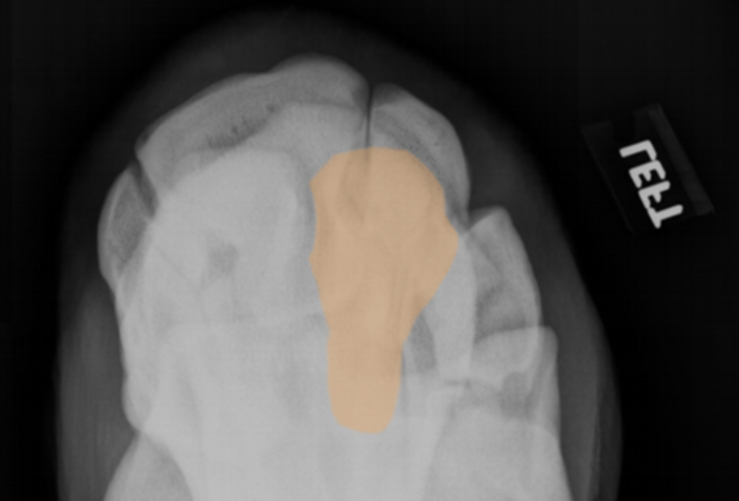<p>What bone is highlighted?</p>