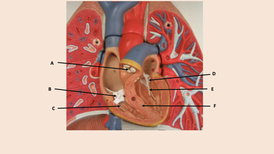 <p>what is A</p>