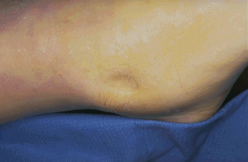<ol><li><p>ID pathology</p></li><li><p>Most likely cause</p></li></ol><p></p>