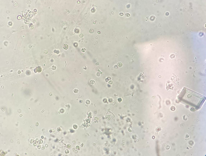 <p>What is the crystal?</p><p>What else do you see on this slide?</p>