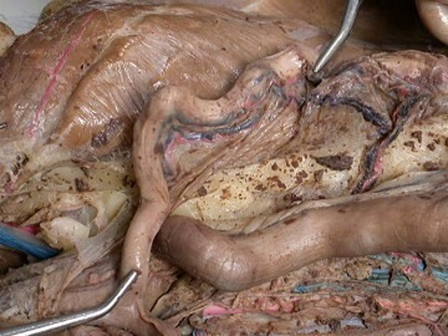 <p>-Where each oviduct merges</p><p>-The right and left horns join in the midline to form the main uterine tube</p><p>-Part of the Female Reproduction Tract</p>