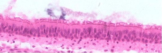 <p>What type of tissue is this? </p>