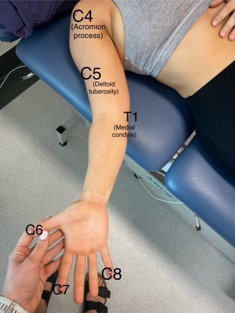 <p>Start with circumfrentials </p><p>C4 - Acromion process </p><p>C5- Deltoid tuberosity </p><p>C6- Thumb</p><p>C7- Index finger</p><p>C8- Little finger</p><p>T1- Medial condyle </p><p></p>