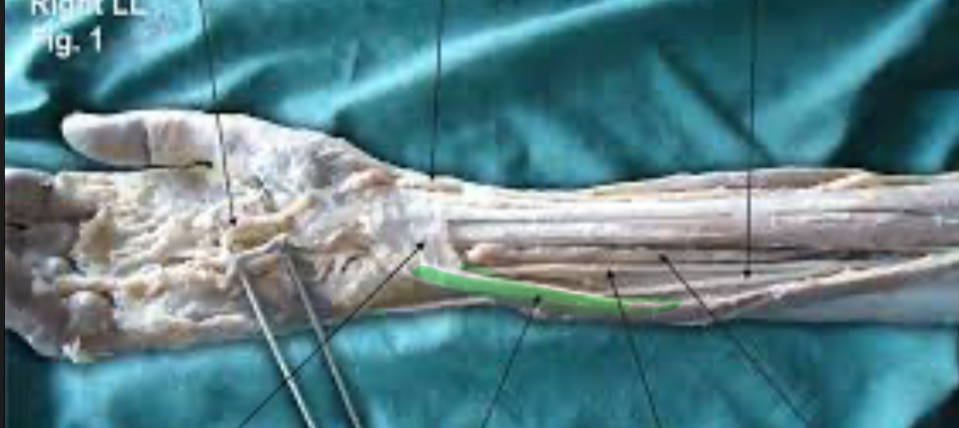 <p>Action: Flex, adduct wrist </p>