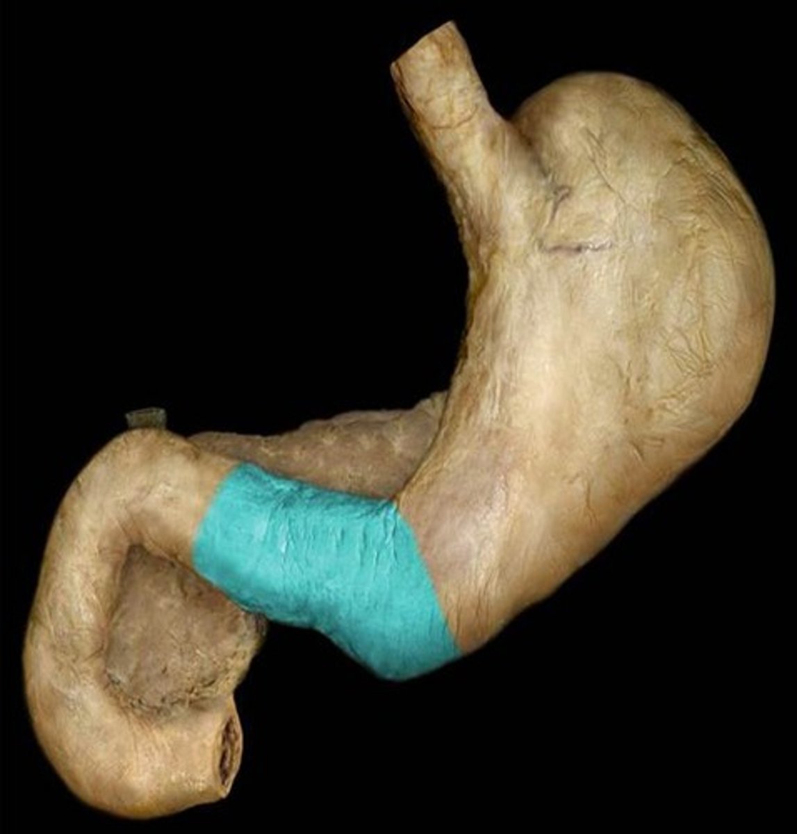 <p>Name this region of the stomach.</p>
