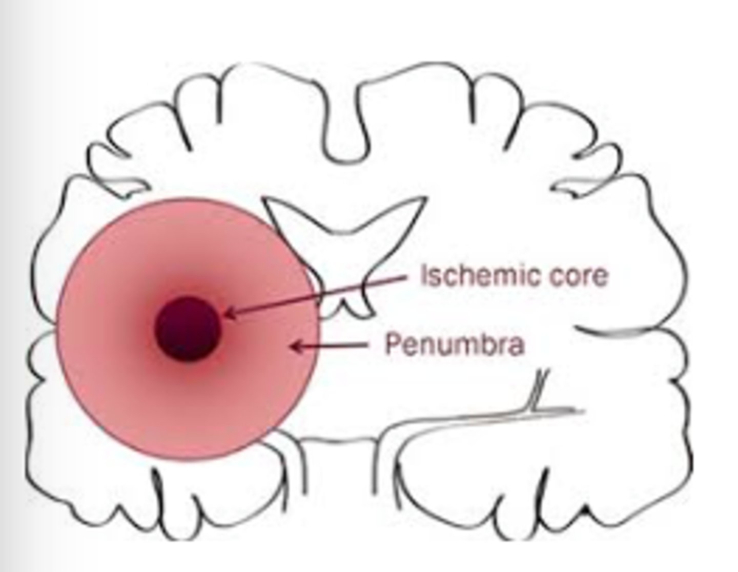 <p>Perimeter around the core ischemic area</p><p>Area can progress to infarction</p>