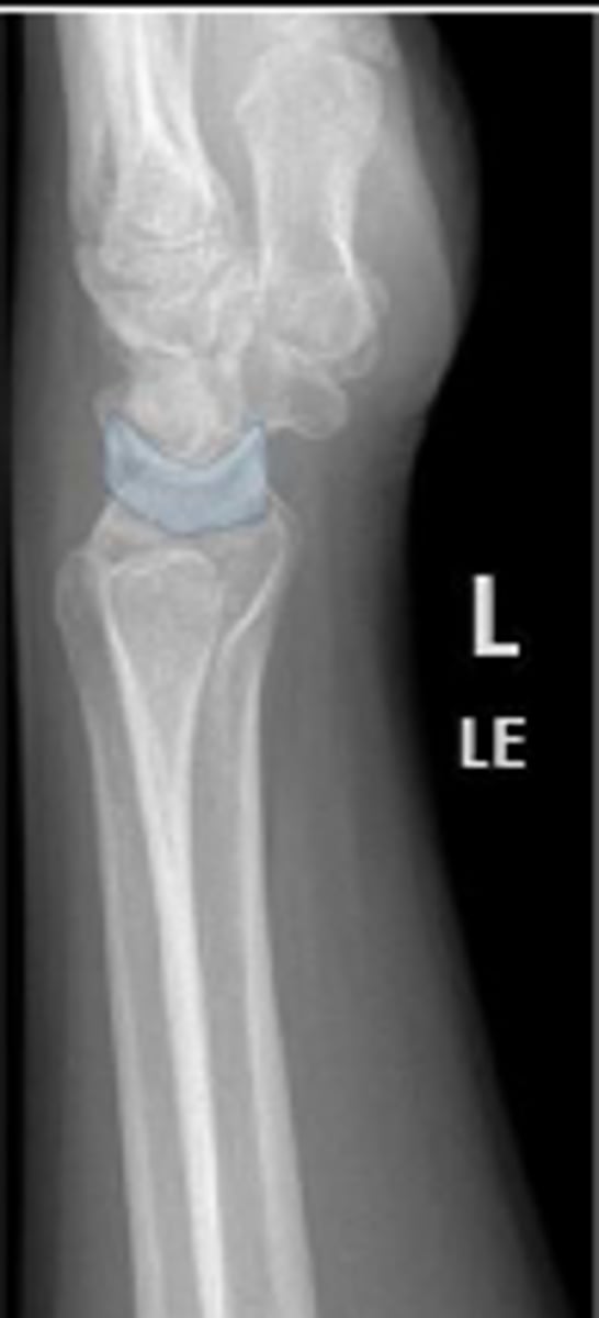 <p>What is outlined?</p>