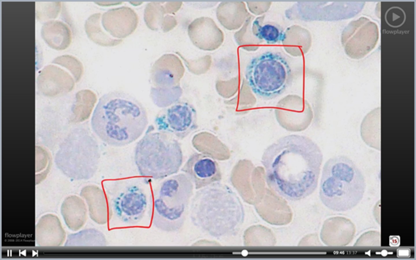 <p>blue ring indicates what; stain?</p>