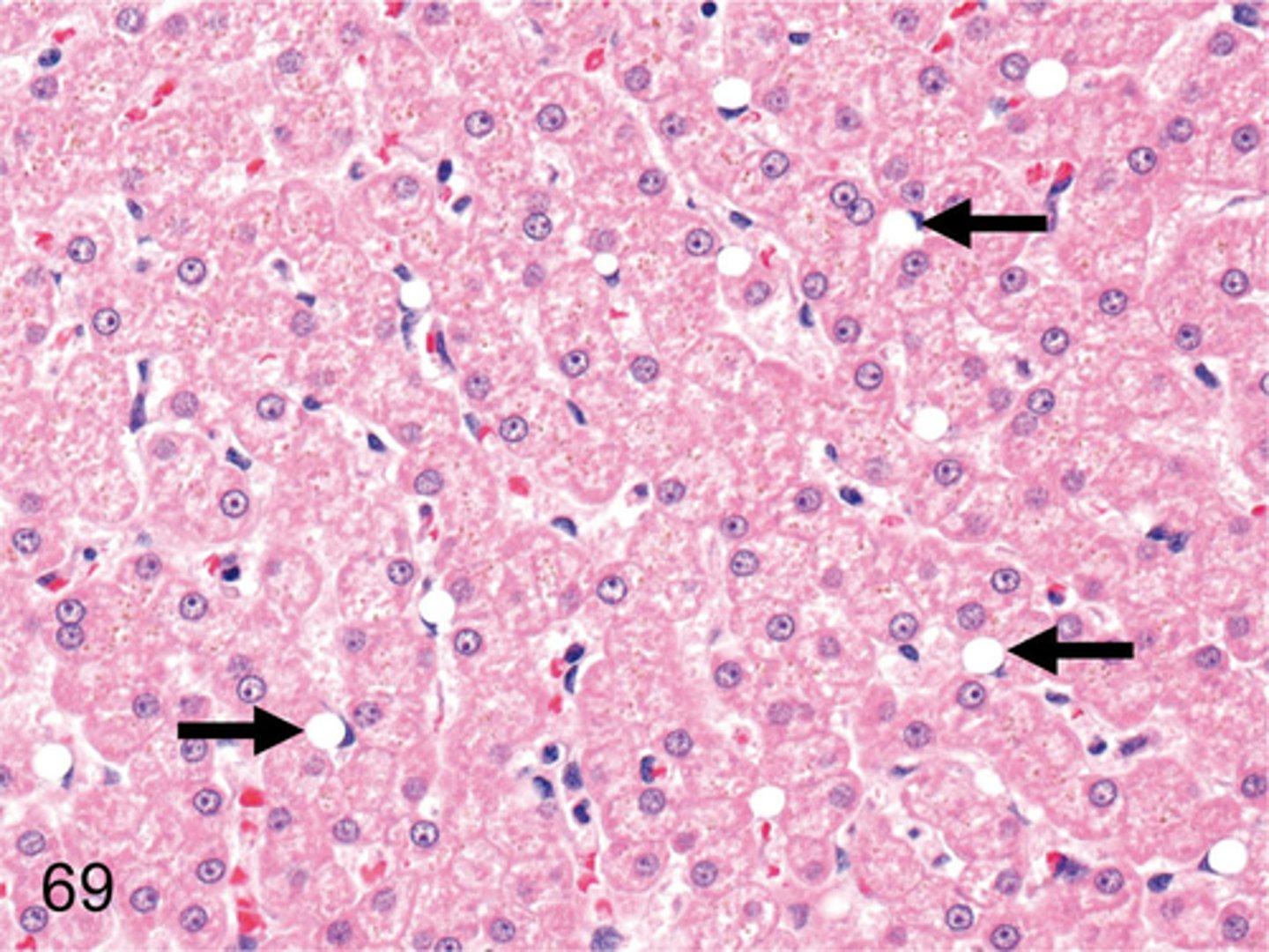 <p>Ito cells, also known as hepatic stellate cells, are responsible for storing vitamin A within the liver.</p>