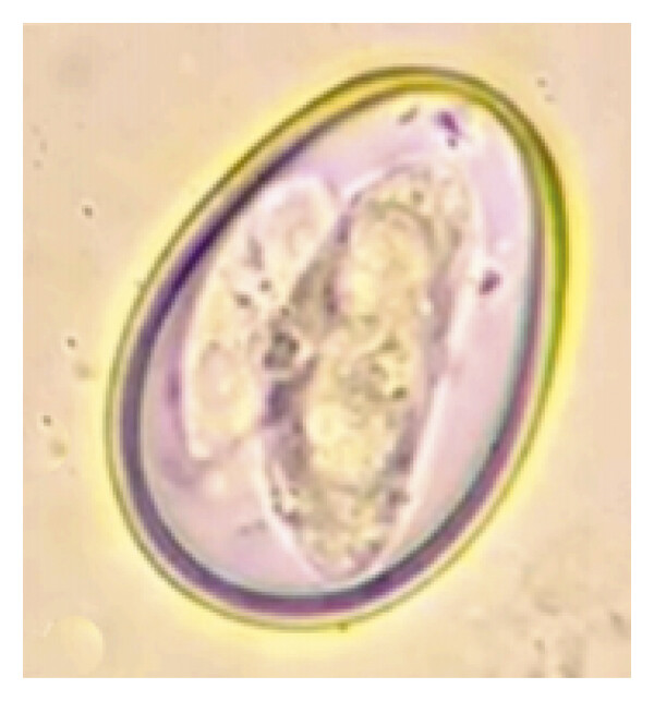 <p>What is this parasite</p>