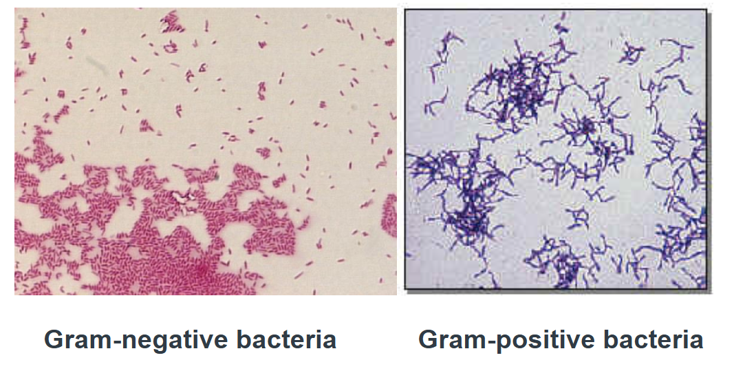 <ul><li><p><span style="font-family: "Century Gothic";"><span>cell wall staining characteristics that lets you classify bacteria as Gram positive or gram negative</span></span></p></li><li><p>purple = gram-positive</p></li><li><p>red = gram-negative</p></li></ul><p></p>