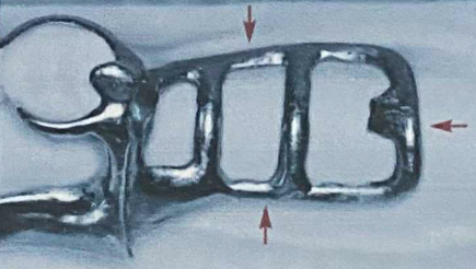 <p>Provides attachment for the denture base and artificial teeth to the major connector</p><p>Used in tooth-supported and distal extension RPDs to carry acrylic base and teeth.</p>