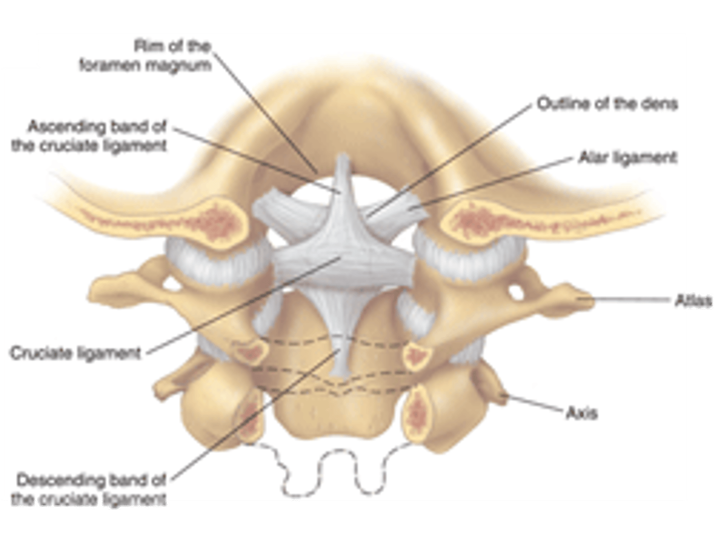 <p>primary passive restraint of C1 translation in the sagittal plane</p><p>- holds dens into C1 arch</p><p>- extremely strong, dens will fracture before the ligament tears</p>