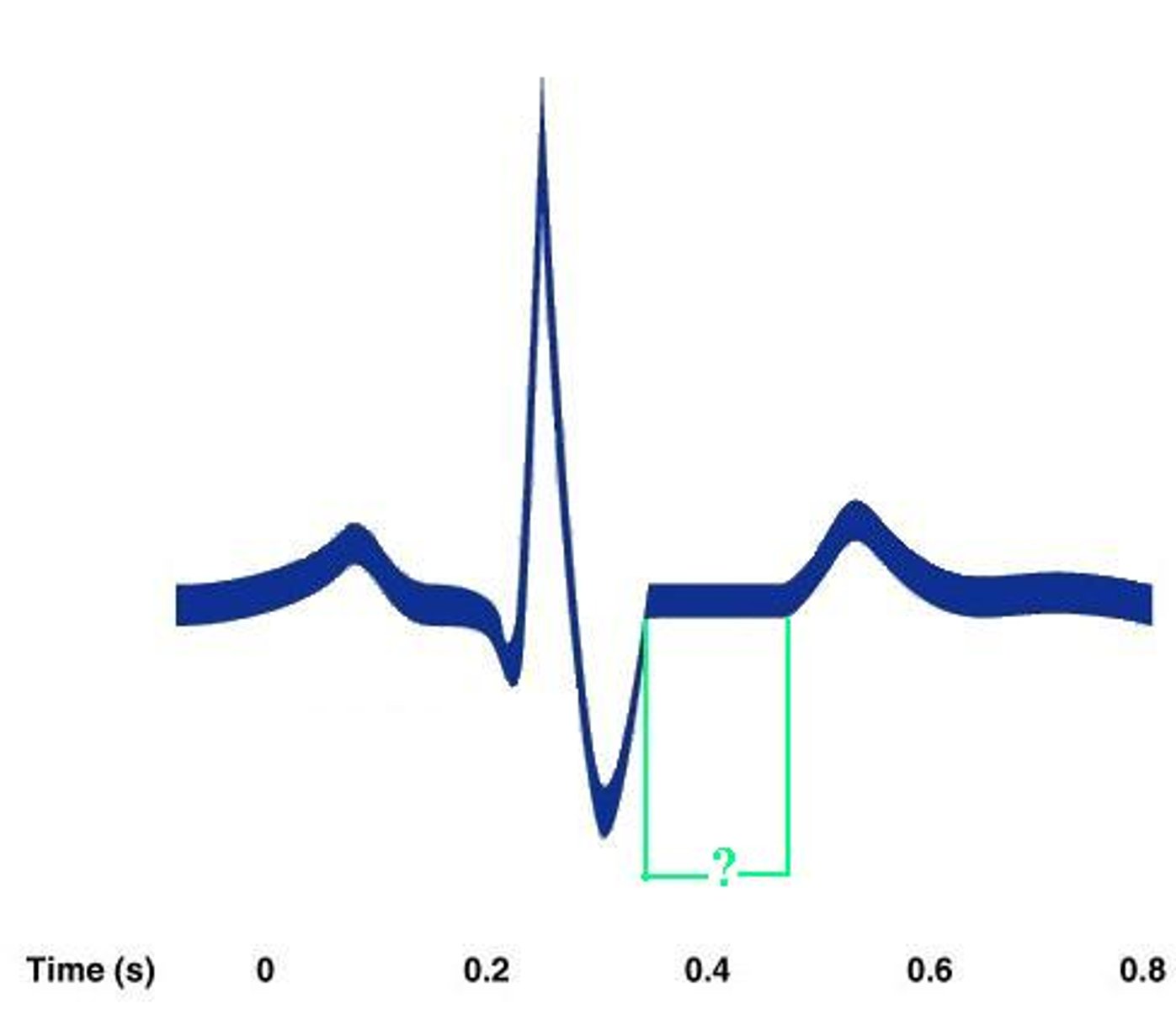 <p>Identify the indicated portion of the EKG.</p>