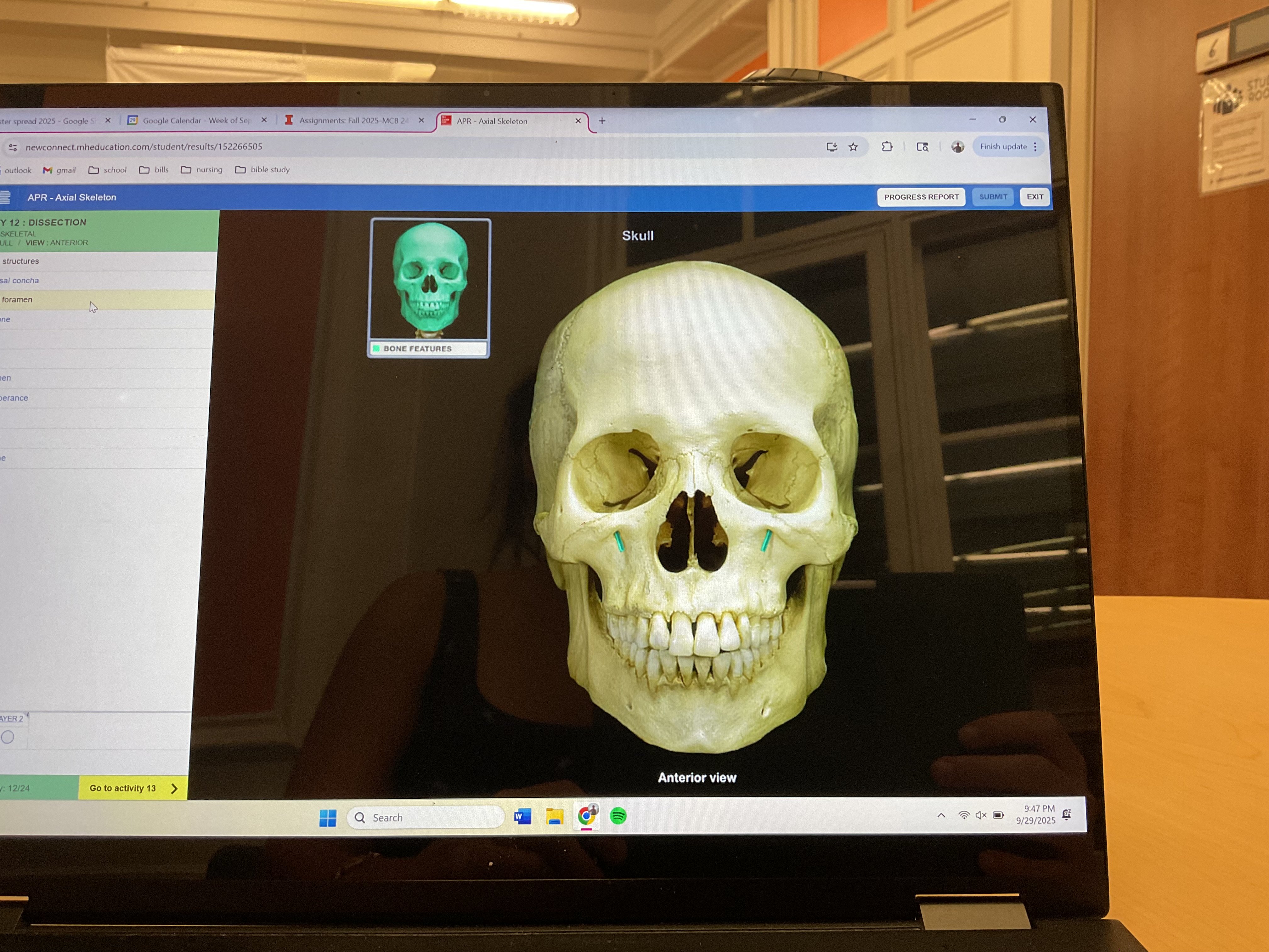 <p>Infraorbital foramen </p>