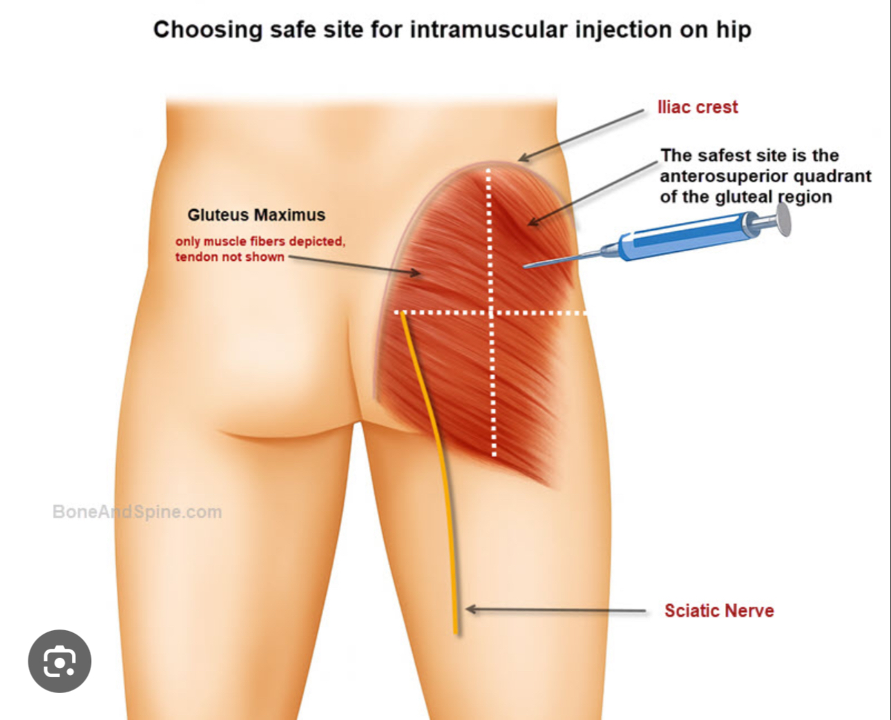 <p>The muscles and region of the buttocks</p>