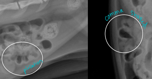 <ul><li><p><span style="background-color: transparent;"><strong><span>Et:</span></strong></span><span style="background-color: transparent; color: green;"><strong><span> </span></strong><span>FB (#1),</span></span><span style="background-color: transparent;"><span> intussusception, neoplasia</span></span></p><ul><li><p><span style="background-color: transparent; color: green;"><strong><span>More Proximal obx = more severe vomiting</span></strong></span></p></li><li><p><span style="background-color: transparent;"><strong><span>Linear:</span></strong><span> #1 cause of Obx </span></span></p><ul><li><p><span style="background-color: transparent; color: green;"><strong><span>Cats</span></strong></span><span style="background-color: transparent;"><span> young (#1)→ </span></span><span style="background-color: transparent; color: green;"><span>base of tongue</span></span></p></li><li><p><span style="background-color: transparent;"><strong><span>Dogs </span></strong><span>older→ pylorus</span></span></p></li></ul></li></ul></li><li><p><span style="background-color: transparent; color: red;"><strong><span>Cs: </span></strong><span>Vomiting, dehydration, lyte imbalance, ± aneroxia, depression, abd. pain, ± shock/sepsis</span></span></p></li></ul><ul><li><p><span style="background-color: transparent;"><strong><span>Dt: PE, </span></strong><span>Palpation, </span><strong><span>survey Rads #1 ± contrast</span></strong><span>, </span></span><span style="background-color: transparent; color: green;"><span>US(more sensitive)</span></span></p><ul><li><p><span style="background-color: transparent;"><span>dilated loops, stacking, gas pattern</span></span></p><ul><li><p>Comma-shaped gas bubbles</p></li></ul></li></ul></li><li><p><span style="background-color: transparent;"><strong><span>Tx: pre anes. fluids</span></strong><span>, Sx once stable, cut string under tongue, </span></span></p><ul><li><p><span style="background-color: transparent;"><strong><u><span>monitor if simple</span></u></strong><span>: Healthy cat (present only 1-2 days) → sx in 12-24h if not better</span></span></p></li></ul></li></ul><p></p>