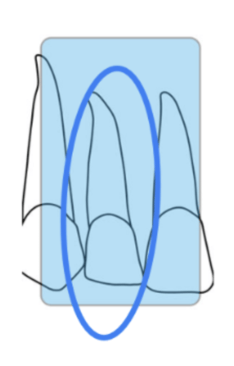 <p>size 1</p><p>mx lateral incisor</p>