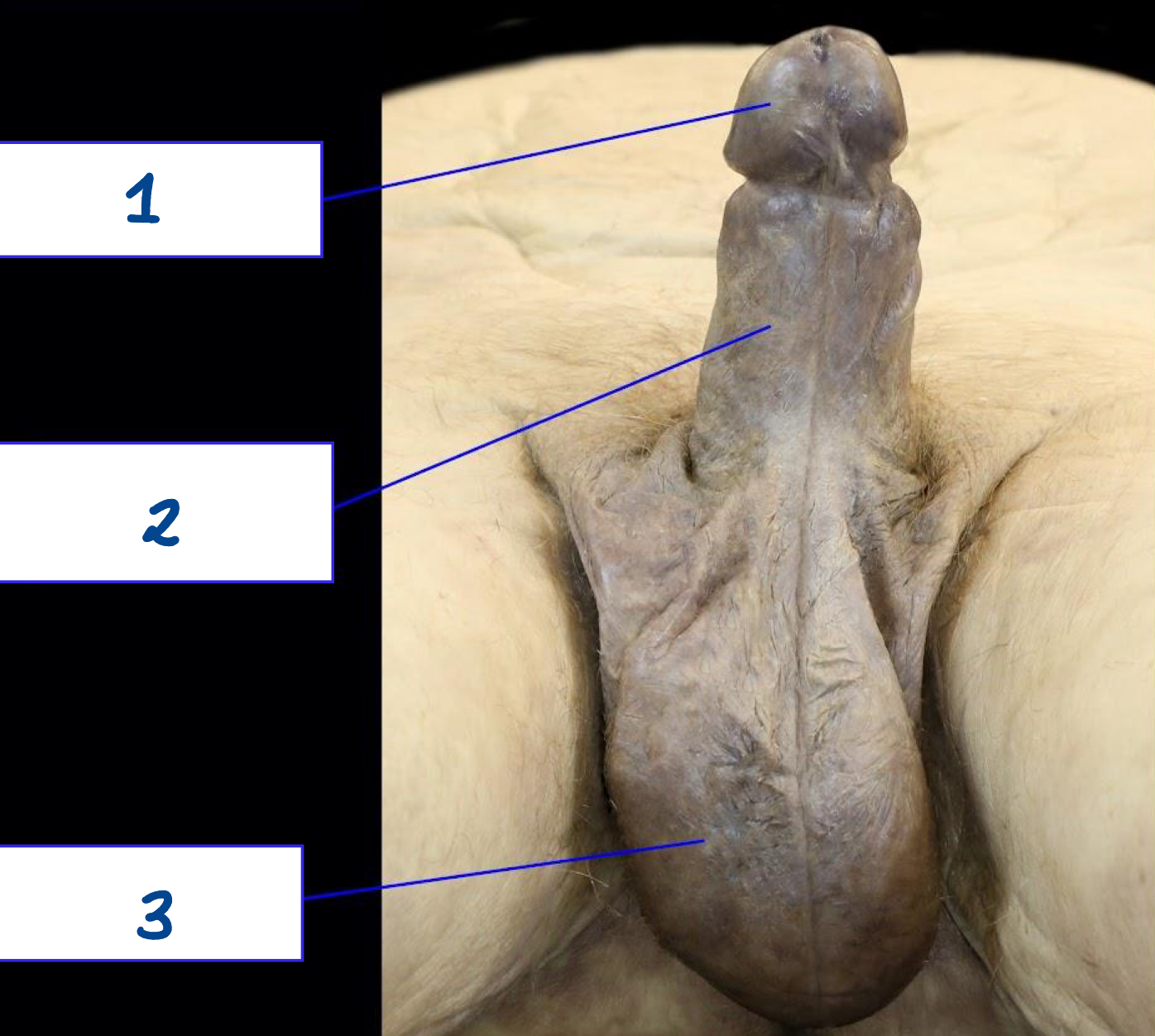 <p>What is structure 1?</p>