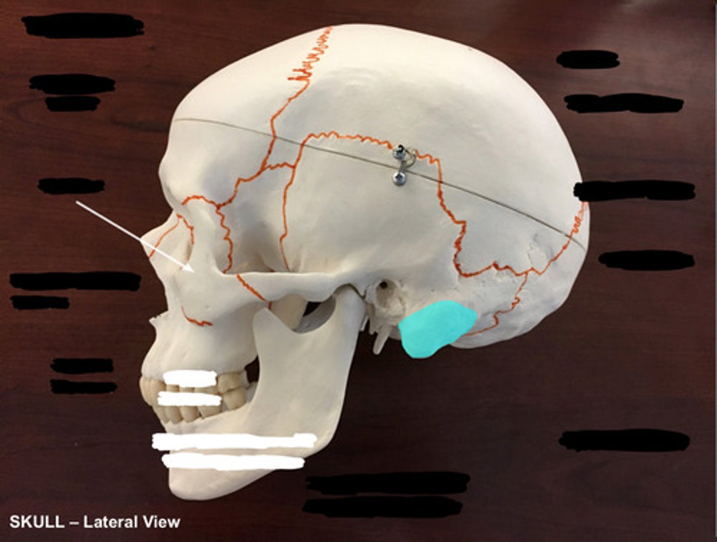 <p>What structure is highlighted here?</p>