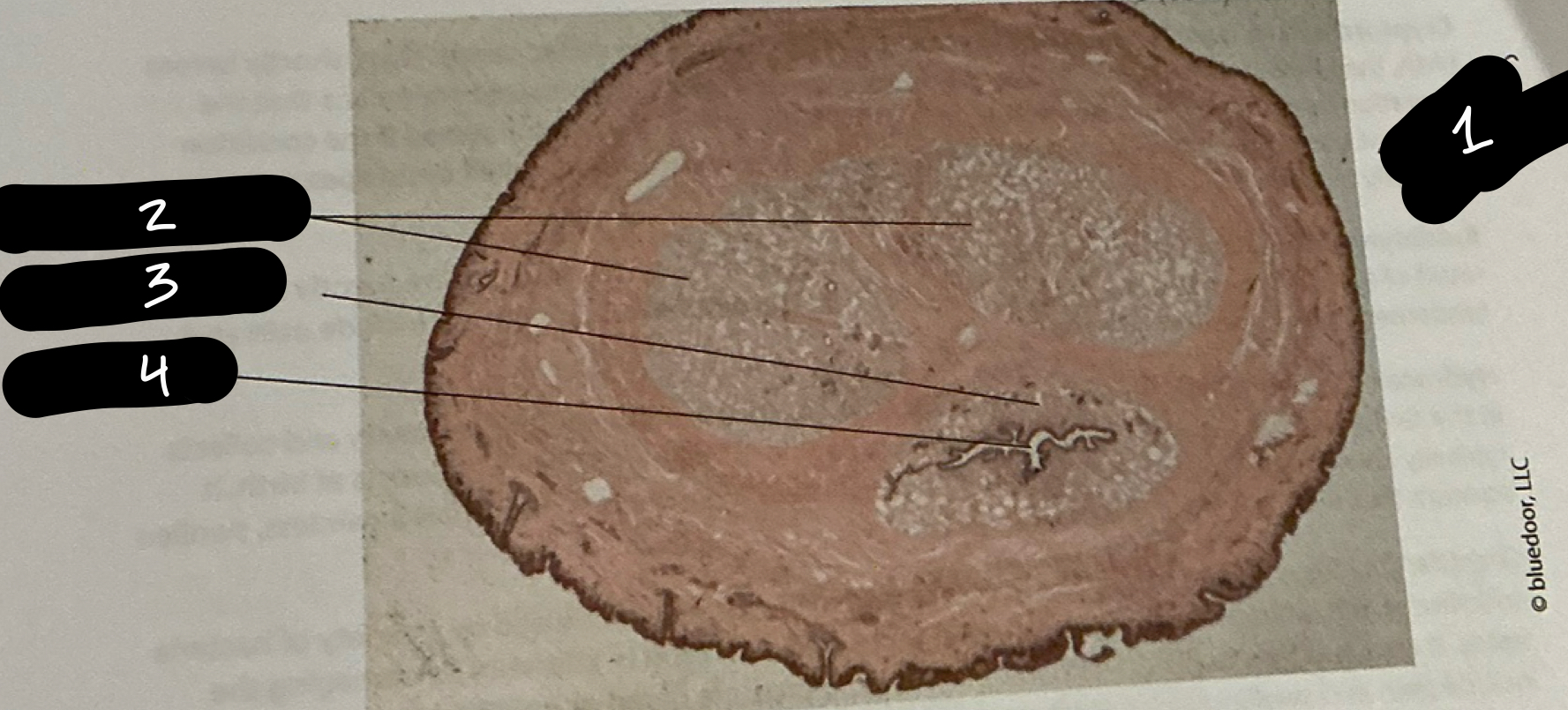 term image