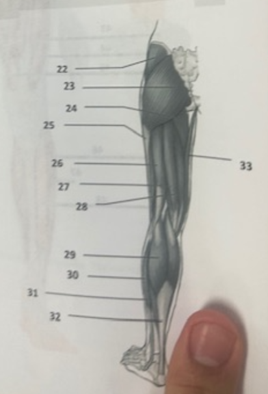 <p>What muscle is 29?</p>