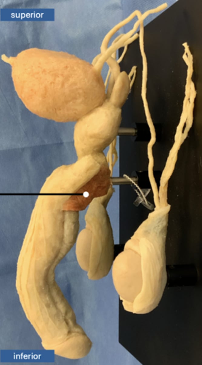 <p>muscle</p>