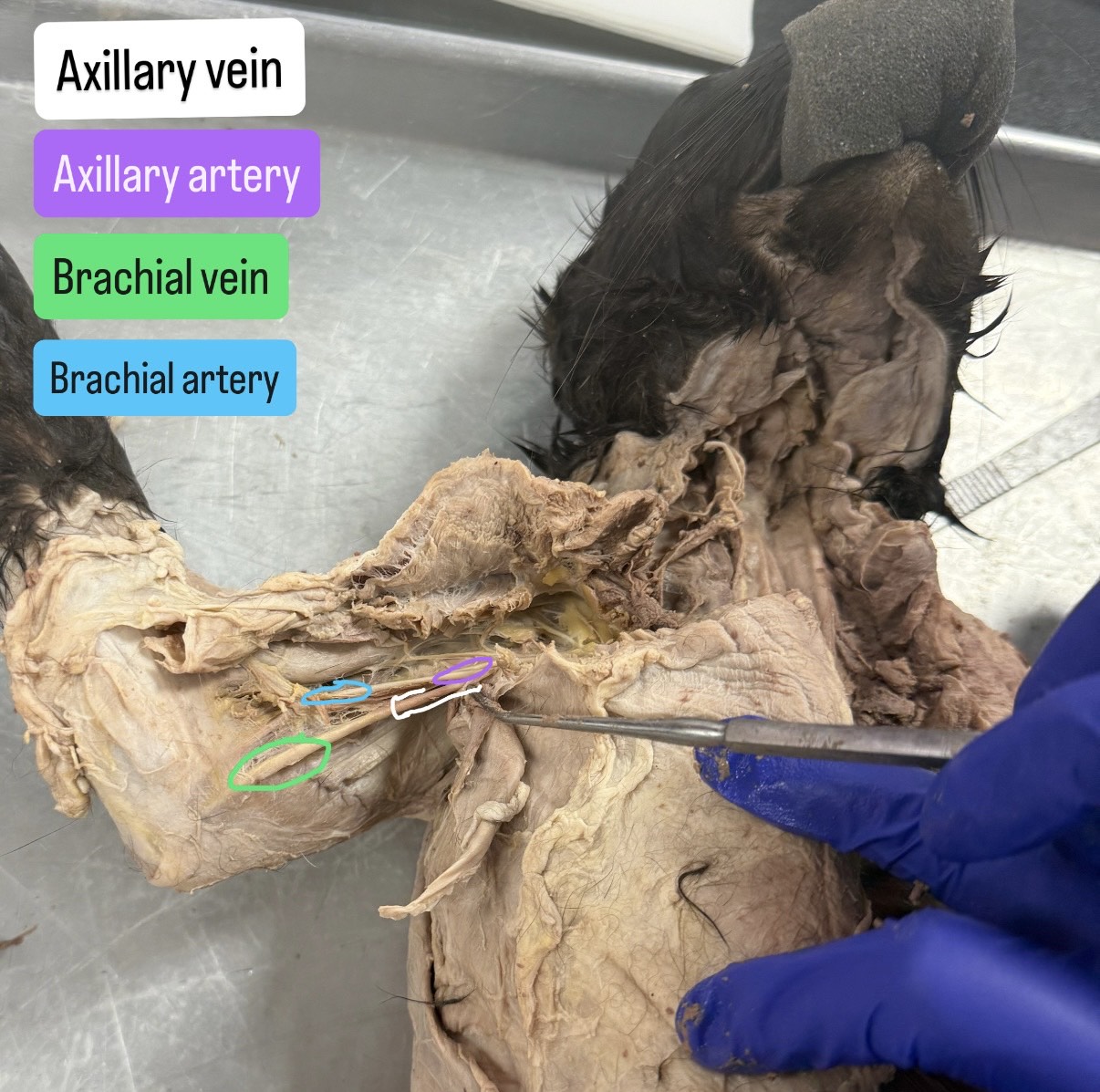 <p>Axillary vein, axillary artery, brachial vein, brachial artery</p>