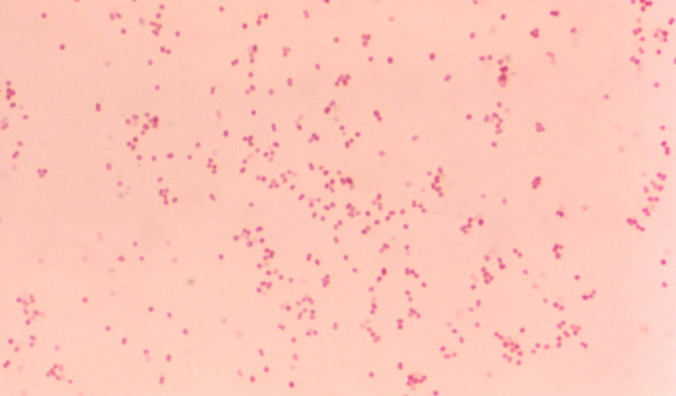 <p>What am i- gram stain, shape, arrangement</p>