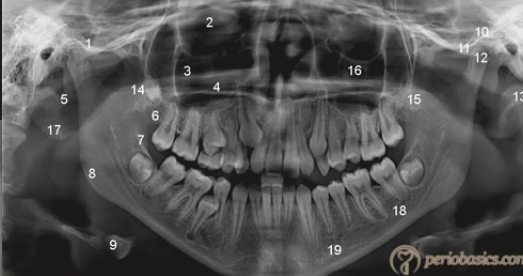 <p>what is this, its description and its appearance on images- 9 </p>