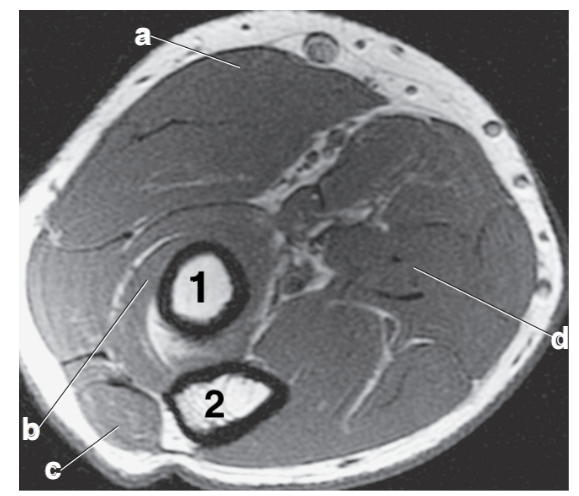<p>What anatomy is # 2?</p>