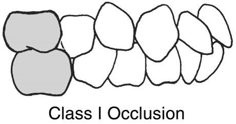<p>Class I Occlusion</p>