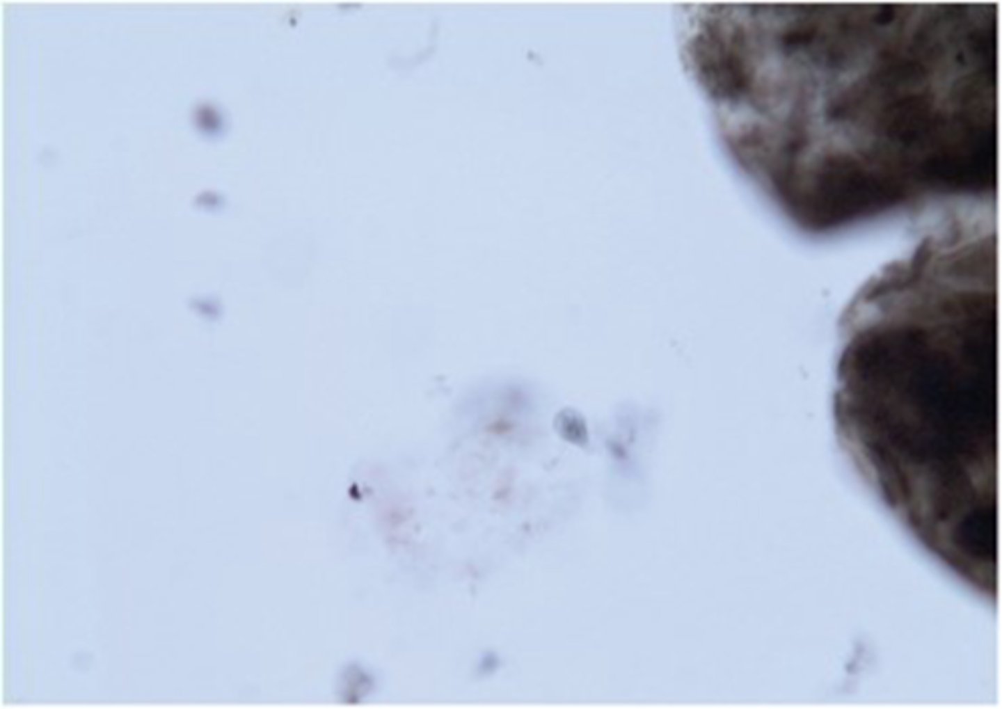 <p>This protozoan flagellate has not been renamed to an assemblage and is still called</p><p>____________ in pet birds.</p>