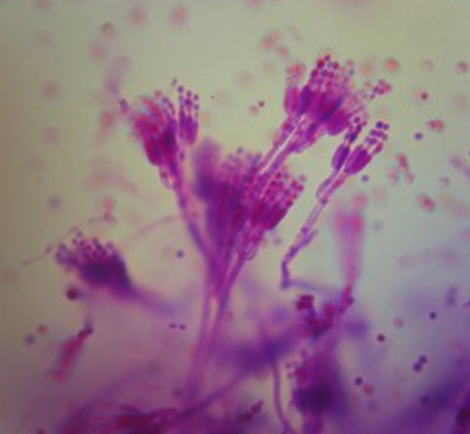 <p>what is this? what genus + fungi type is it?</p>