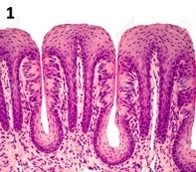 <p>what type of papillae?</p>