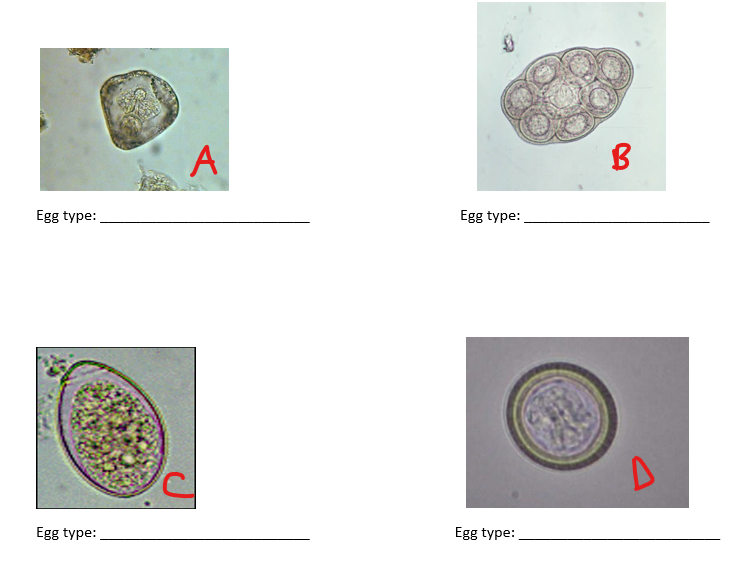 <p>Write the letters A-D. Write the name of the egg type next to its letter and give an example of a parasite we've seen that has each type of egg.</p>