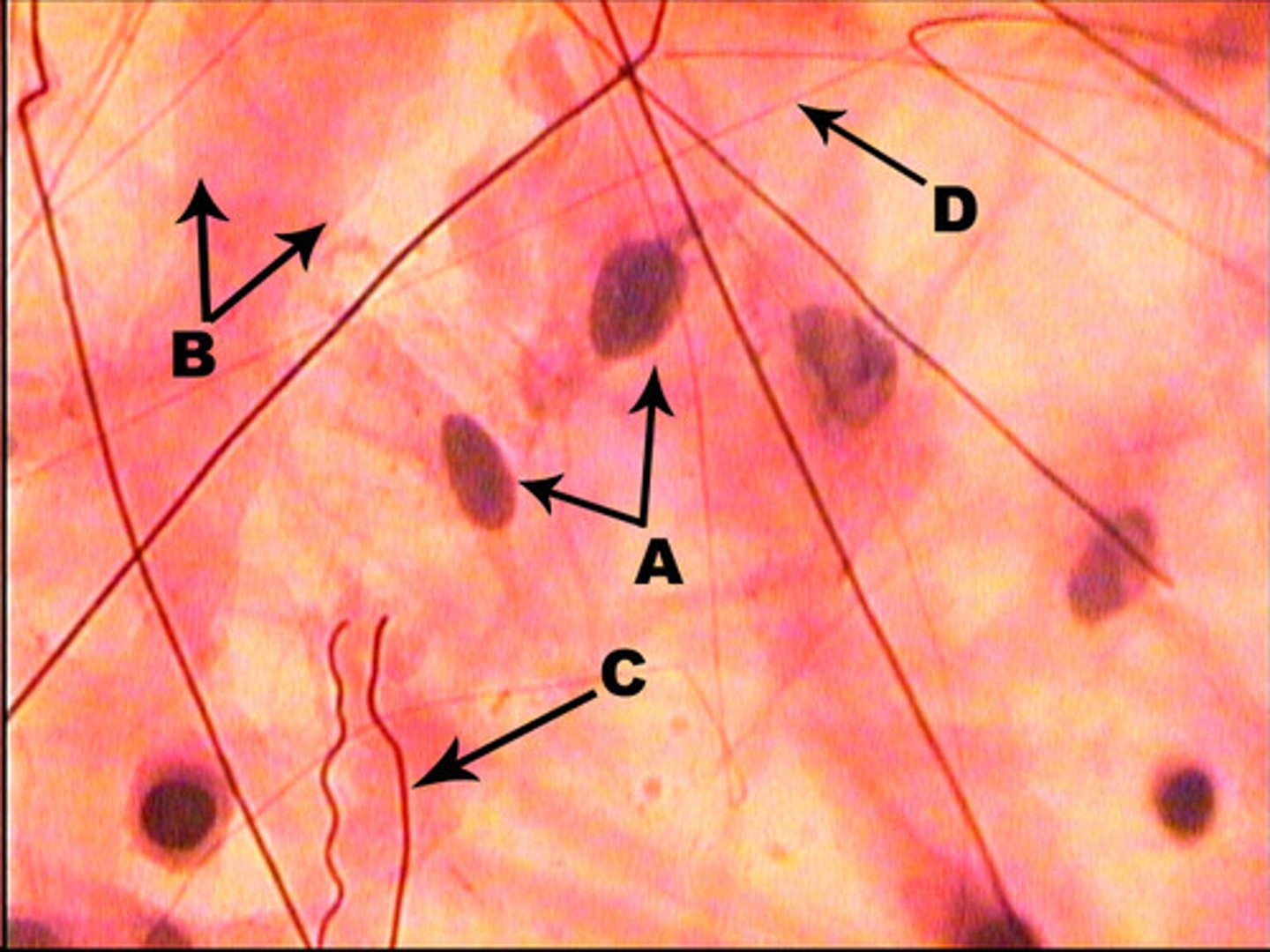 <p>small, have numerous fibers (elastic &amp; collagenous) coursing between cells</p><p>found between the skin and muscle</p><p>function: attach skin to muscle</p>