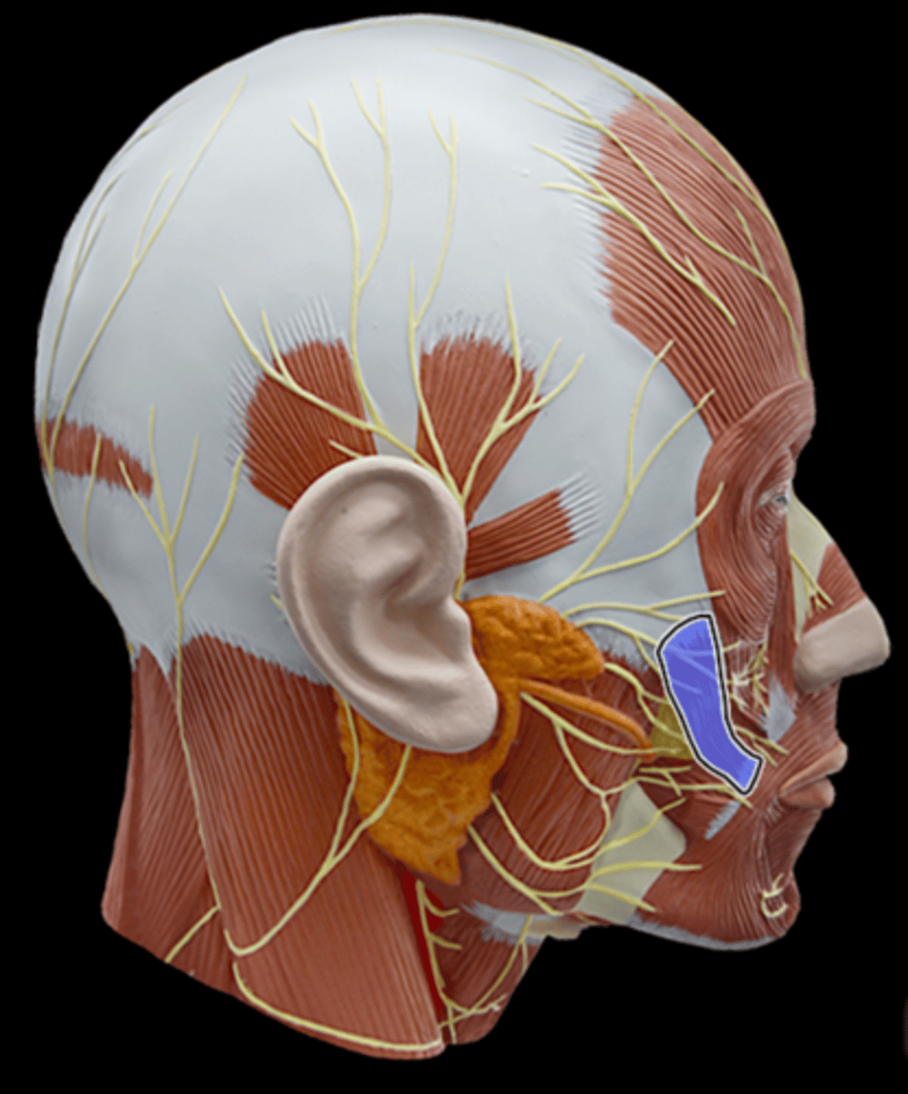 <p>What Muscle Is Highlighted?</p>
